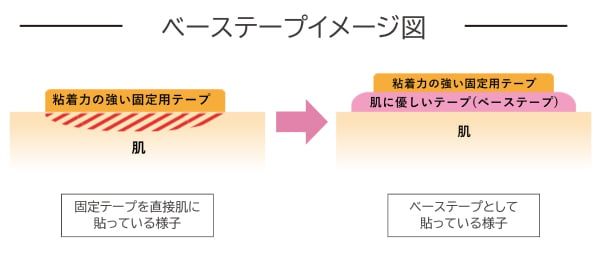 ドレッシングテープ 安い 直接 使い方