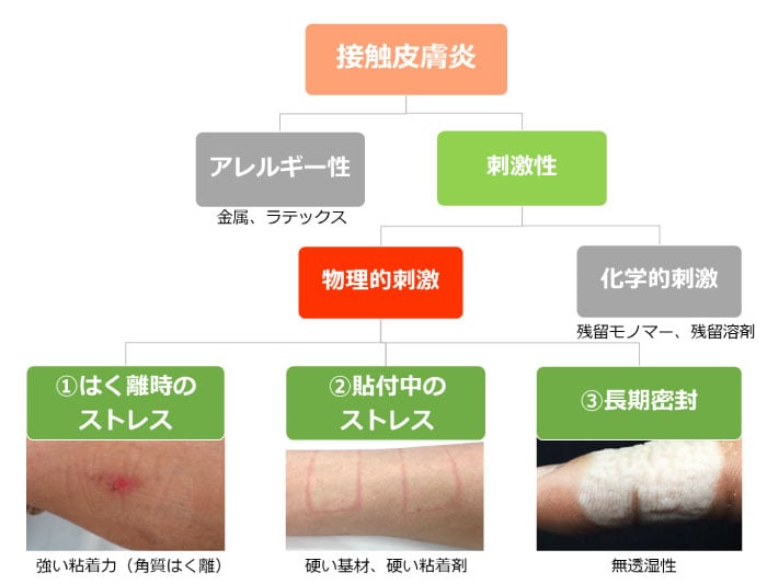 コレクション テープ 剥がす 皮膚