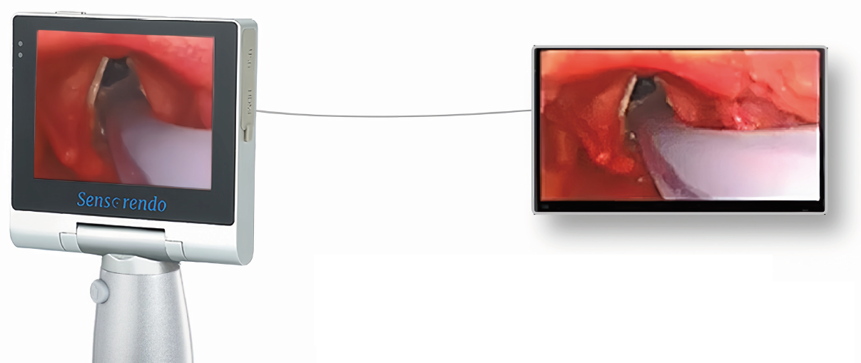 喉头镜/视频喉头镜是2