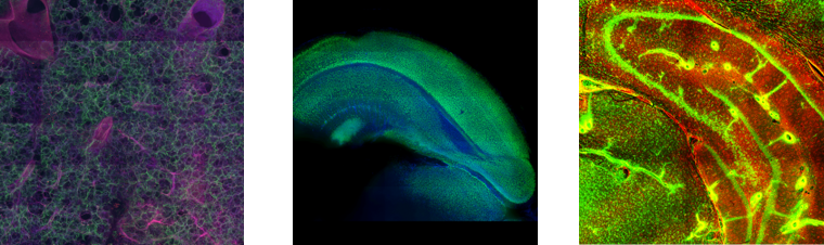 【極美品】角結膜がみえてくる生体共焦点顕微鏡検査 IN VIVO BIOPSY 電子顕微鏡アトラス 心内膜下心筋生検 endomyocardial biopsy